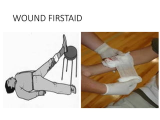 WOUND FIRSTAID
 
