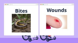 Bites Wounds
 