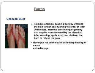 Burns
Chemical Burn
 Remove chemical causing burn by washing
the skin under cool running water for at least
20 minutes. Remove all clothing or jewelry
that may be contaminated by the chemical.
After washing, apply cool, wet cloth on the
After washing, apply cool, wet cloth on the
burn to relieve the pain.
 Never put ice on the burn, as it delay healing or
cause
extra damage
 