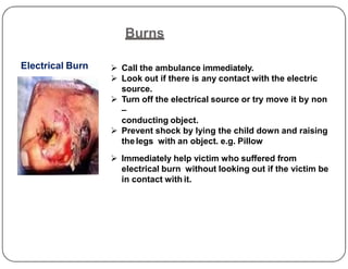 Burns
Electrical Burn  Call the ambulance immediately.
 Look out if there is any contact with the electric
source.
 Turn off the electrical source or try move it by non
–
conducting object.
 Prevent shock by lying the child down and raising
 Prevent shock by lying the child down and raising
thelegs with an object. e.g. Pillow
 Immediately help victim who suffered from
electrical burn without looking out if the victim be
in contact with it.
 