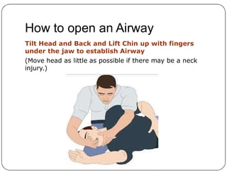 How to open an Airway
Tilt Head and Back and Lift Chin up with fingers
under the jaw to establish Airway
(Move head as little as possible if there may be a neck
injury.)
 