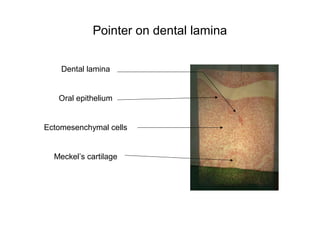 Pointer on dental lamina
Dental lamina
Oral epithelium
Ectomesenchymal cells
Meckel’s cartilage
 