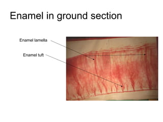 Enamel in ground section
Enamel lamella
Enamel tuft
 