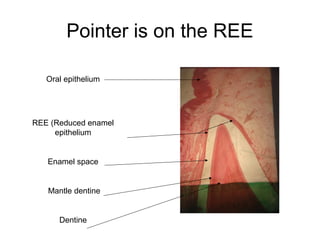 Pointer is on the REE
Oral epithelium
REE (Reduced enamel
epithelium
Enamel space
Mantle dentine
Dentine
 