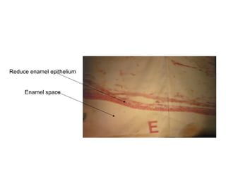 Reduce enamel epithelium
Enamel space
 