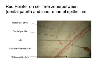 Red Pointer on cell free zone(between
dental papilla and inner enamel epithelium(
Fibroblast cells
Dental papilla
IEE
Stratum intermedium
Stellate reticulum
 