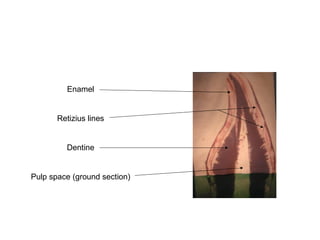 Enamel
Retizius lines
Dentine
Pulp space (ground section(
 