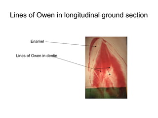 Lines of Owen in longitudinal ground section
Enamel
Lines of Owen in dentin
 