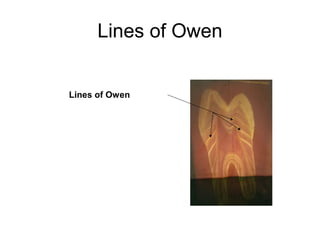 Lines of Owen
Lines of Owen
 
