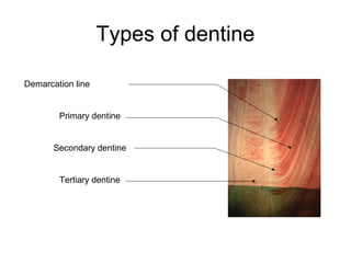 Types of dentine
Demarcation line
Primary dentine
Secondary dentine
Tertiary dentine
 