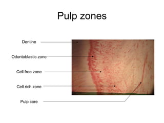 Pulp zones
Dentine
Odontoblastic zone
Cell free zone
Cell rich zone
Pulp core
 