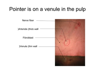 Pointer is on a venule in the pulp
Nerve fiber
Arteriole (thick wall(
Fibroblast
Venule (thin wall(
 