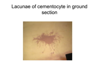 Lacunae of cementocyte in ground
section
 