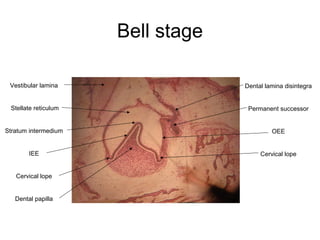 Bell stage
Vestibular lamina
Stellate reticulum
Stratum intermedium
IEE
Cervical lope
Dental papilla
Dental lamina disintegra
Permanent successor
OEE
Cervical lope
 
