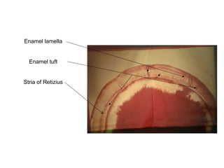 Enamel lamella
Enamel tuft
Stria of Retizius
 