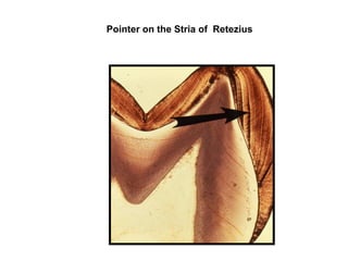 Pointer on the Stria of Retezius
 