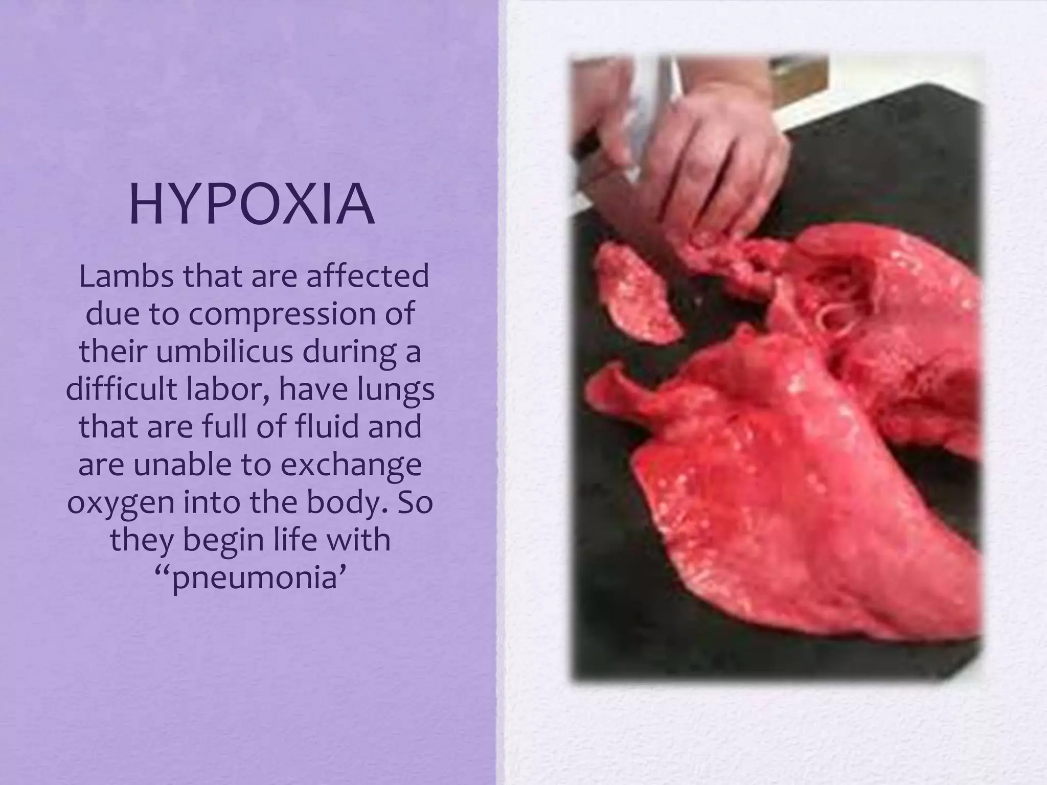 HYPOXIA
Lambs that are affected
due to compression of
their umbilicus during a
difficult labor, have lungs
that are full of fluid and
are unable to exchange
oxygen into the body. So
they begin life with
“pneumonia’

 