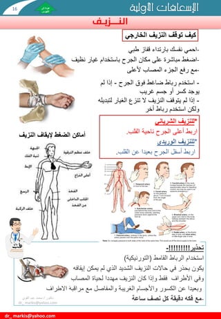 ‫النـــزيـف‬
‫األولية‬ ‫اإلسعافات‬
dr_ markis@yahoo.com
‫الخارجي‬ ‫النزيف‬ ‫توقف‬ ‫كيف‬
-
‫طبي‬ ‫قفاز‬ ‫بارتداء‬ ‫نفسك‬ ‫احمي‬
-
‫نظيف‬ ‫غيار‬ ‫باستخدام‬ ‫الجرح‬ ‫مكان‬ ‫على‬ ‫مباشرة‬ ‫اضغط‬
-
‫ألعلى‬ ‫المصاب‬ ‫الجزء‬ ‫رفع‬ ‫مع‬
-
‫الجرح‬ ‫فوق‬ ‫ضاغط‬ ‫رباط‬ ‫استخدم‬
-
‫لم‬ ‫إذا‬
‫غريب‬ ‫جسم‬ ‫أو‬ ‫كسر‬ ‫يوجد‬
-
‫لت‬ ‫الغيار‬ ‫تنزع‬ ‫ال‬ ‫النزيف‬ ‫يتوقف‬ ‫لم‬ ‫إذا‬
‫بديله‬
‫أخر‬ ‫رباط‬ ‫استخدم‬ ‫ولكن‬
‫تحذير‬
!!!!!!!!!
-
‫الرباط‬ ‫استخدام‬
‫القامط‬
(
‫التورنيكية‬
)
‫إيقافه‬ ‫يمكن‬ ‫لم‬ ‫الذي‬ ‫الشديد‬ ‫النزيف‬ ‫حاالت‬ ‫في‬ ‫بحذر‬ ‫يكون‬
‫المصاب‬ ‫لحياة‬ ‫مهددا‬ ‫النزيف‬ ‫كان‬ ‫وإذا‬ ‫فقط‬ ‫األطراف‬ ‫وفي‬
‫األطراف‬ ‫مراقبة‬ ‫مع‬ ‫والمفاصل‬ ‫الغريبة‬ ‫واألجسام‬ ‫الكسور‬ ‫عن‬ ‫وبعيدا‬
-
‫ساعة‬ ‫نصف‬ ‫كل‬ ‫دقيقة‬ ‫فكه‬ ‫مع‬
‫دكتور‬
/
‫القوي‬ ‫عبد‬ ‫محمد‬
dr_ markis@yahoo.com
‫النزيف‬ ‫إليقاف‬ ‫الضغط‬ ‫أماكن‬
*
‫للنزيف‬
‫الشرياني‬
‫القلب‬ ‫ناحية‬ ‫الجرح‬ ‫أعلى‬ ‫اربط‬
.
*
‫الوريدي‬ ‫للنزيف‬
‫القلب‬ ‫عن‬ ‫بعيدا‬ ‫الجرح‬ ‫أسفل‬ ‫اربط‬
.
16
 