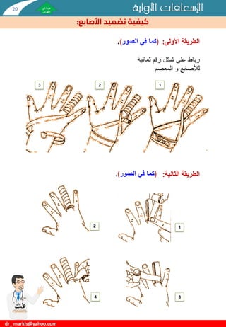 ‫األولية‬ ‫اإلسعافات‬
‫تضميد‬ ‫كيفية‬
‫األصابع‬
:
‫األولى‬ ‫الطريقة‬
:
‫رباط‬
‫ثمانية‬ ‫رقم‬ ‫شكل‬ ‫على‬
‫و‬ ‫لألصابع‬
‫المعصم‬
‫الثانية‬ ‫الطريقة‬
:
(
‫في‬ ‫كما‬
‫الصور‬
)
.
(
‫في‬ ‫كما‬
‫الصور‬
)
.
dr_ markis@yahoo.com
1
2
3
1
2
3
4
20
 