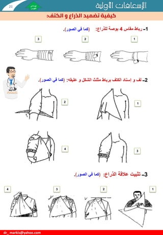 ‫األولية‬ ‫اإلسعافات‬
‫الكتف‬ ‫و‬ ‫الذراع‬ ‫تضميد‬ ‫كيفية‬
:
dr_ markis@yahoo.com
1
‫ــ‬
‫مقاس‬ ‫رباط‬
4
‫للذراع‬ ‫بوصة‬
:
2
‫ــ‬
‫عليقه‬ ‫و‬ ‫الشكل‬ ‫مثلث‬ ‫برباط‬ ‫الكتف‬ ‫إسناد‬ ‫و‬ ‫لف‬
:
1
2
3
1
2
3
4
(
‫في‬ ‫كما‬
‫الصور‬
)
.
3
‫ــ‬
‫الذراع‬ ‫عالقة‬ ‫تثبيت‬
:
1
2
3
4
(
‫في‬ ‫كما‬
‫الصور‬
)
.
(
‫في‬ ‫كما‬
‫الصور‬
)
.
21
 