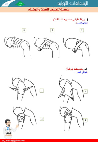 ‫األولية‬ ‫اإلسعافات‬
‫الفخذ‬ ‫تضميد‬ ‫كيفية‬
‫والركبة‬
:
dr_ markis@yahoo.com
1
‫ــ‬
‫للفخذ‬ ‫بوصات‬ ‫ست‬ ‫مقياس‬ ‫رباط‬
:
(
‫الصور‬ ‫في‬ ‫كما‬
)
:
2
‫ــ‬
‫للركبة‬ ‫مثلث‬ ‫رباط‬
:
(
‫الصور‬ ‫في‬ ‫كما‬
)
:
1
2
3
4
1
2
3
22
 