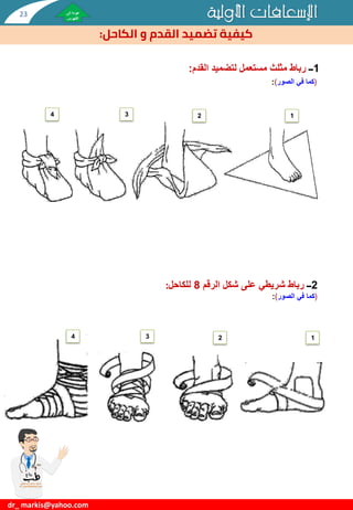 ‫األولية‬ ‫اإلسعافات‬
‫و‬ ‫القدم‬ ‫تضميد‬ ‫كيفية‬
‫الكاحل‬
:
dr_ markis@yahoo.com
1
‫ــ‬
‫القدم‬ ‫لتضميد‬ ‫مستعمل‬ ‫مثلث‬ ‫رباط‬
:
(
‫الصور‬ ‫في‬ ‫كما‬
)
:
2
‫ــ‬
‫الرقم‬ ‫شكل‬ ‫على‬ ‫شريطي‬ ‫رباط‬
8
‫للكاحل‬
:
(
‫الصور‬ ‫في‬ ‫كما‬
)
:
1
2
3
4
1
2
3
4
23
 