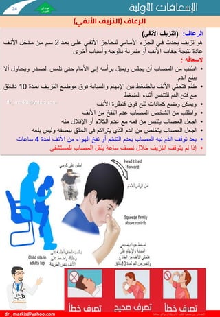 ‫األولية‬ ‫اإلسعافات‬
‫مختلفة‬ ‫ومواقع‬ ‫األمريكية‬ ‫القلب‬ ‫جمعية‬ ‫من‬ ‫المصادر‬
‫الرعاف‬
(
‫األنفي‬ ‫النزيف‬
)
dr_ markis@yahoo.com
‫الرعاف‬
:
(
‫األنفي‬ ‫النزيف‬
)
‫بعيد‬ ‫عليى‬ ‫األنفيي‬ ‫للحياجز‬ ‫األميامي‬ ‫الجيزء‬ ‫فيي‬ ‫يحدث‬ ‫نزيف‬ ‫هو‬
2
‫األنيف‬ ‫ميدخل‬ ‫مين‬ ‫سيم‬
‫أخرى‬ ‫وأسباب‬ ‫بالوجه‬ ‫ضربة‬ ‫أو‬ ‫األنف‬ ‫جفاف‬ ‫نتيجة‬ ‫عادة‬
‫إلسعافه‬
:
•
‫ويحياو‬ ‫الصيدر‬ ‫تلمس‬ ‫حتى‬ ‫األمام‬ ‫إلى‬ ‫برأسه‬ ‫ويميل‬ ‫يجلس‬ ‫أن‬ ‫المصاب‬ ‫من‬ ‫اطلب‬
‫أال‬ ‫ل‬
‫الدم‬ ‫يبلع‬
•
‫ل‬ ‫النزييف‬ ‫موضيع‬ ‫فوق‬ ‫والسبابة‬ ‫اإلبهام‬ ‫بين‬ ‫بالضغط‬ ‫األنف‬ ‫فتحتي‬ ‫م‬ُ‫ض‬
‫ميدة‬
10
‫دقيائق‬
‫الضغط‬ ‫أثناء‬ ‫للتنفس‬ ‫الفم‬ ‫فتح‬ ‫مع‬
•
‫األنف‬ ‫قنطرة‬ ‫فوق‬ ‫ثلج‬ ‫كمادات‬ ‫وضع‬ ‫ويمكن‬
•
‫األنف‬ ‫من‬ ‫النفخ‬ ‫عدم‬ ‫المصاب‬ ‫الشخص‬ ‫من‬ ‫واطلب‬
•
‫منه‬ ‫اإلقالل‬ ‫أو‬ ‫الكالم‬ ‫عدم‬ ‫مع‬ ‫فمه‬ ‫من‬ ‫يتنفس‬ ‫المصاب‬ ‫اجعل‬
•
‫يتراكم‬ ‫الذي‬ ‫الدم‬ ‫من‬ ‫يتخلص‬ ‫المصاب‬ ‫اجعل‬
‫فى‬
‫بلع‬ ‫وليس‬ ‫ببصقه‬ ‫الحلق‬
‫ه‬
•
‫لمدة‬ ‫األنف‬ ‫من‬ ‫الهواء‬ ‫نفخ‬ ‫أو‬ ‫التنخم‬ ‫بعدم‬ ‫المصاب‬ ‫نبه‬ ‫الدم‬ ‫توقف‬ ‫بعد‬
4
‫ساعات‬
•
‫المصاب‬ ‫ينقل‬ ‫ساعة‬ ‫نصف‬ ‫خالل‬ ‫النزيف‬ ‫يتوقف‬ ‫لم‬ ‫إذا‬
‫للمستشفى‬
dr_ markis@yahoo.com
24
 