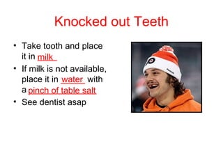 Knocked out Teeth
• Take tooth and place
it in ____
• If milk is not available,
place it in _____ with
a ______________
• See dentist asap
milk
water
pinch of table salt
 