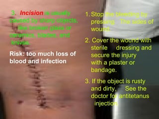 Dicing Injuries First aid | PPT