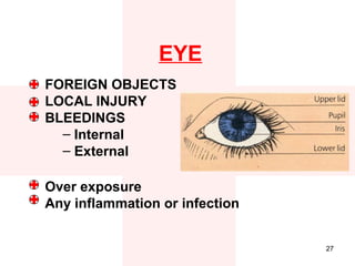 EYE
FOREIGN OBJECTS
LOCAL INJURY
BLEEDINGS
  – Internal
  – External

Over exposure
Any inflammation or infection


                                27
 