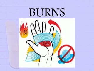 BURNS
 