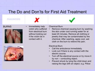 The Do and Don’ts for First Aid Treatment
DIAGNOSIS
BURNS • Immediately help
victim who suffered
from electrical burn
without looking out
if the victim be in
contact with it.
Chemical Burn
• Remove chemical causing burn by washing
the skin under cool running water for at
least 20 minutes. Remove all clothing or
jewelry that may be contaminated by the
chemical. After washing, apply cool, wet
cloth on the burn to relieve the pain.
Electrical Burn
• Call the ambulance immediately.
• Look out if there is any contact with the
electric source.
• Turn off the electrical source or try move it
by non – conducting object.
• Prevent shock by lying the child down and
raising the legs with an object. e.g. Pillow
 