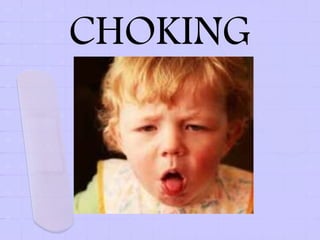 CHOKING
 