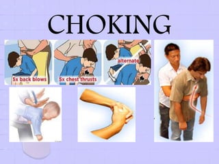 CHOKING
 
