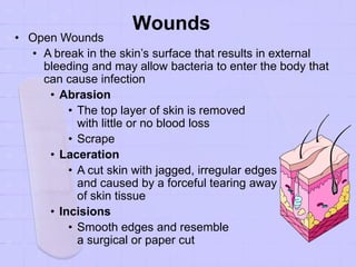 Wounds
• Open Wounds
• A break in the skin’s surface that results in external
bleeding and may allow bacteria to enter the body that
can cause infection
• Abrasion
• The top layer of skin is removed
with little or no blood loss
• Scrape
• Laceration
• A cut skin with jagged, irregular edges
and caused by a forceful tearing away
of skin tissue
• Incisions
• Smooth edges and resemble
a surgical or paper cut
 