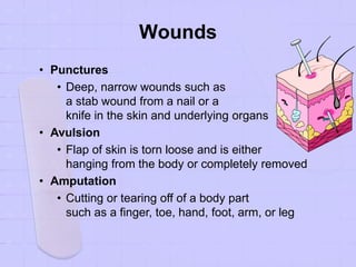 Wounds
• Punctures
• Deep, narrow wounds such as
a stab wound from a nail or a
knife in the skin and underlying organs
• Avulsion
• Flap of skin is torn loose and is either
hanging from the body or completely removed
• Amputation
• Cutting or tearing off of a body part
such as a finger, toe, hand, foot, arm, or leg
 