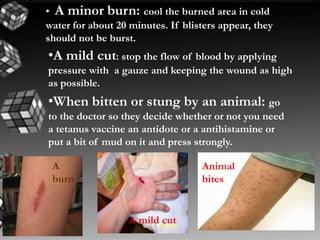 • A minor burn: cool the burned area in cold
water for about 20 minutes. If blisters appear, they
should not be burst.

•A mild cut: stop the flow of

blood by applying
pressure with a gauze and keeping the wound as high
as possible.

•When bitten or stung by an animal: go
to the doctor so they decide whether or not you need
a tetanus vaccine an antidote or a antihistamine or
put a bit of mud on it and press strongly.
A
burn

Animal
bites

A mild cut

 