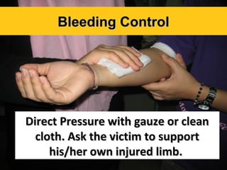 Bleeding Control

Direct Pressure with gauze or clean
cloth. Ask the victim to support
his/her own injured limb.

 