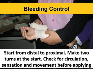 Bleeding Control

Start from distal to proximal. Make two
turns at the start. Check for circulation,
sensation and movement before applying

 