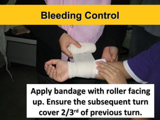 Bleeding Control

Apply bandage with roller facing
up. Ensure the subsequent turn
cover 2/3rd of previous turn.

 