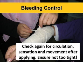 Bleeding Control

Check again for circulation,
sensation and movement after
applying. Ensure not too tight!

 