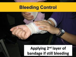 Bleeding Control

Applying 2nd layer of
bandage if still bleeding

 