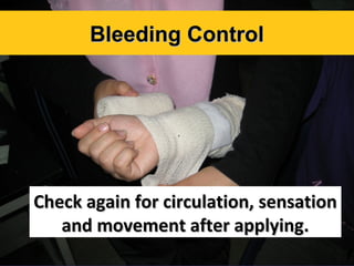 Bleeding Control

Check again for circulation, sensation
and movement after applying.

 