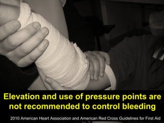 Elevation and use of pressure points are
not recommended to control bleeding
2010 American Heart Association and American Red Cross Guidelines for First Aid

 