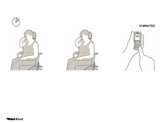 10 MINUTES

•12
•Step 2.1.
•Step 3. Bleed
•Step
•Nose

 