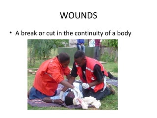 WOUNDS
• A break or cut in the continuity of a body

 