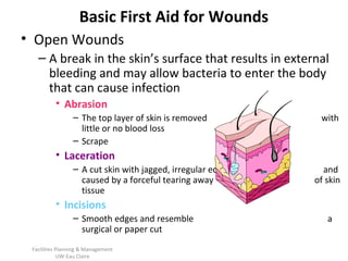 Basic First Aid for Wounds
• Open Wounds
– A break in the skin’s surface that results in external
bleeding and may allow bacteria to enter the body
that can cause infection
• Abrasion
– The top layer of skin is removed
little or no blood loss
– Scrape

with

• Laceration
– A cut skin with jagged, irregular edges
caused by a forceful tearing away
tissue

and
of skin

• Incisions
– Smooth edges and resemble
surgical or paper cut
Facilities Planning & Management
UW-Eau Claire

a

 