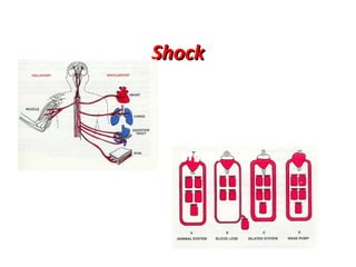 Shock
Shock affects all
major functions of the
body
loss of blood flow to
the tissues and
organs
Shock must be
treated in all
accident cases

 
