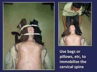 Use bags or
pillows, etc, to
immobilize the
cervical spine

 