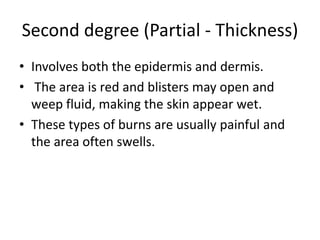 Second degree (Partial - Thickness)
• Involves both the epidermis and dermis.
• The area is red and blisters may open and
weep fluid, making the skin appear wet.
• These types of burns are usually painful and
the area often swells.
 